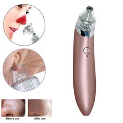4-in-1 Multifunctional Beauty Pore Vacuum