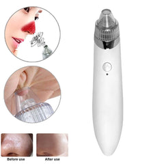 4-in-1 Multifunctional Beauty Pore Vacuum